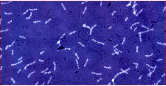 leuconostoc-suvun bakteeri