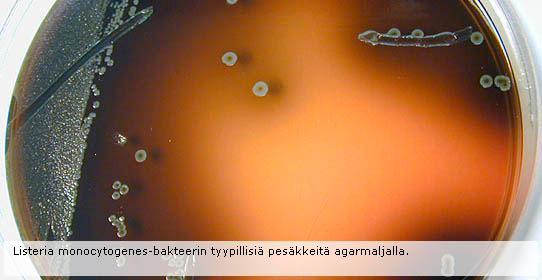 patogeeni mikrobeita petrimaljalla