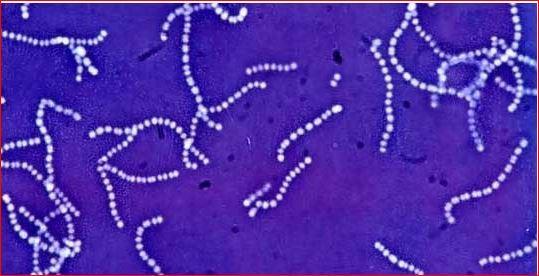 streptococcus-suvun bakteeri